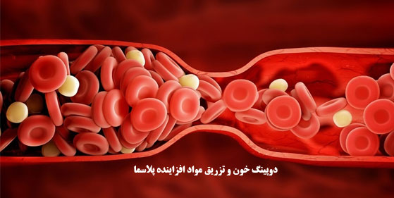 دوپینگ خون و تزریق مواد افزاینده پلاسما