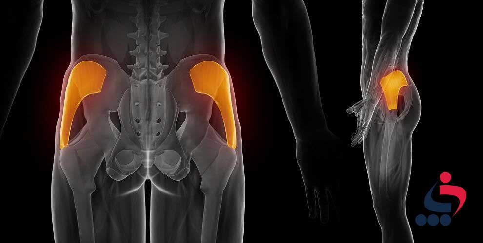 تقویت عضله اصلی باسن(gluteus medius)