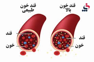 ایا شما هم جزو بیش از ۷.۵ میلیون نفر مبتلا به دیابت در کشور هستید؟